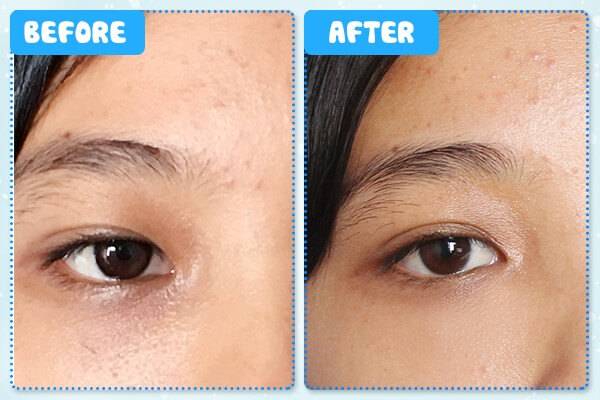 Vùng da dưới mắt sáng hơn, đôi mắt trẻ trung hơn sau khi dùng Murad Eye Cream
