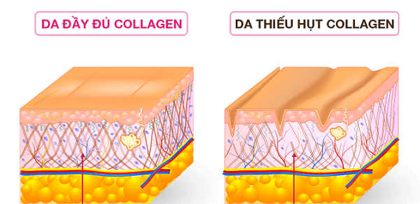 Từ năm 20 tuổi, collagen sụt giảm 1% mỗi năm