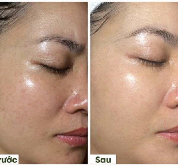 Da chị Hoài đều màu hơn nhờ Murad City Skin Overnight Detox Moisturizer Da chị Hoài đều màu hơn nhờ Murad City Skin OvernightDa chị Hoài đều màu hơn nhờ Murad City Skin Overnight Detox Moisturizer Detox Moisturizer