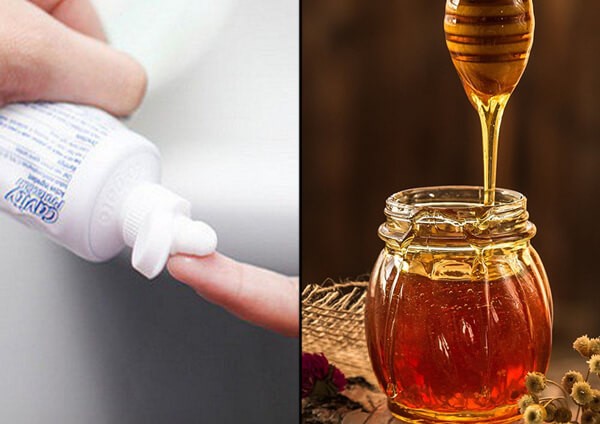Hỗn hợp kem đánh răng và mật ong trị mụn, dưỡng da an toàn
