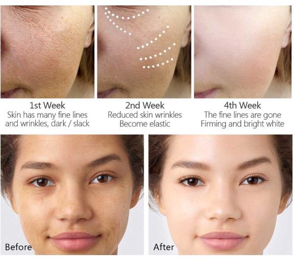 Hiệu quả sau khi dùng sữa rửa mặt Skin Resurfacing Cleanser